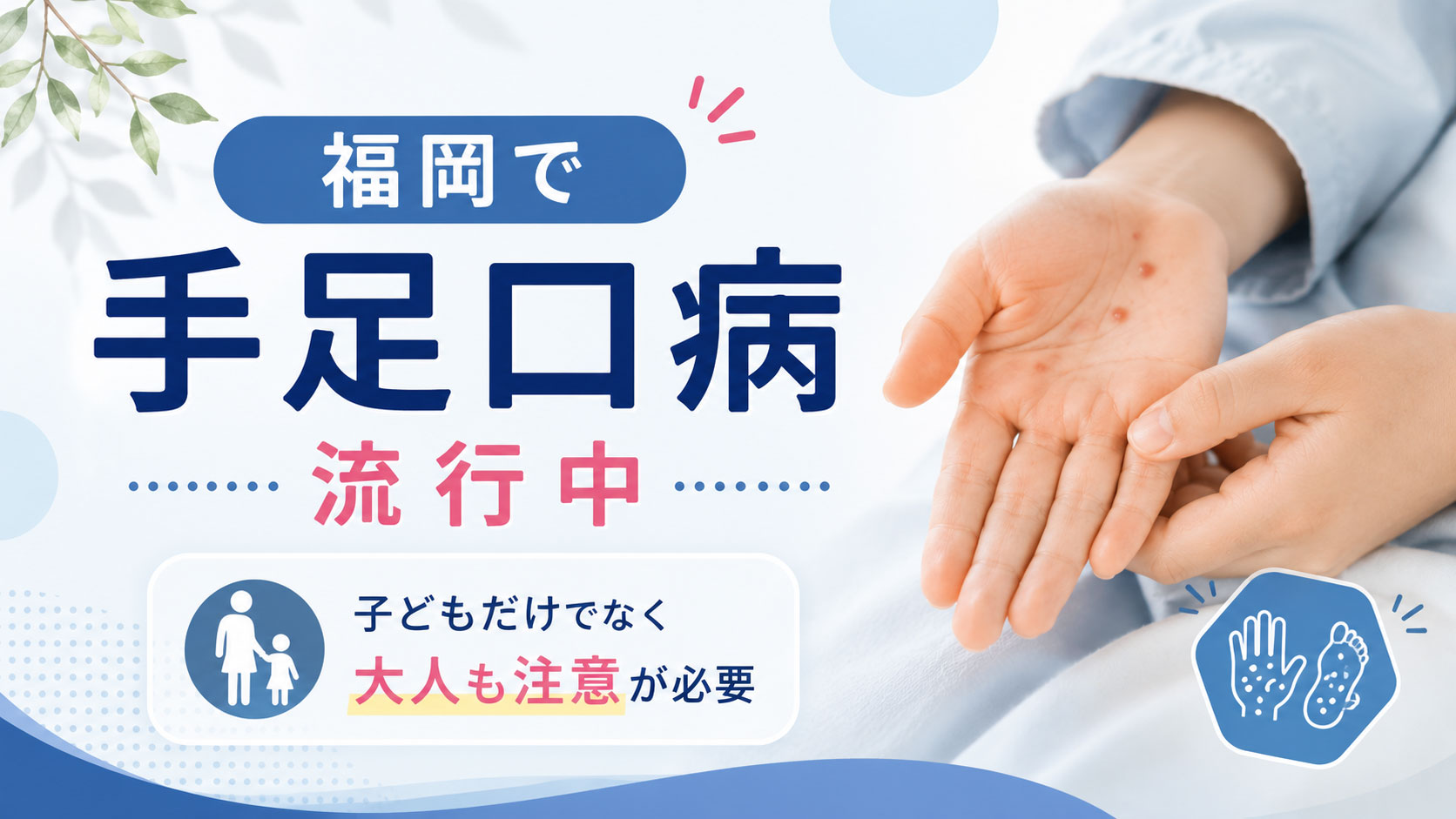 福岡で手足口病が流行中｜子どもだけでなく大人も注意が必要